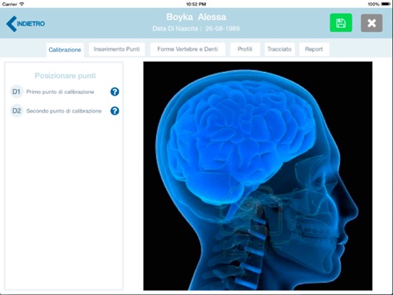 Screenshot #5 pour SmartCeph Pro