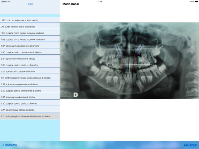 E.P.I.C. Early Prevention Impacted Canines(圖1)-速報App