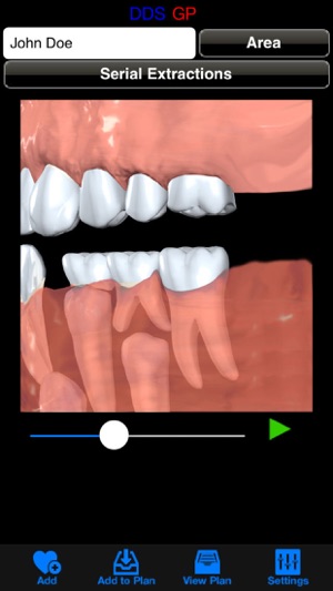 DDS GP(圖4)-速報App