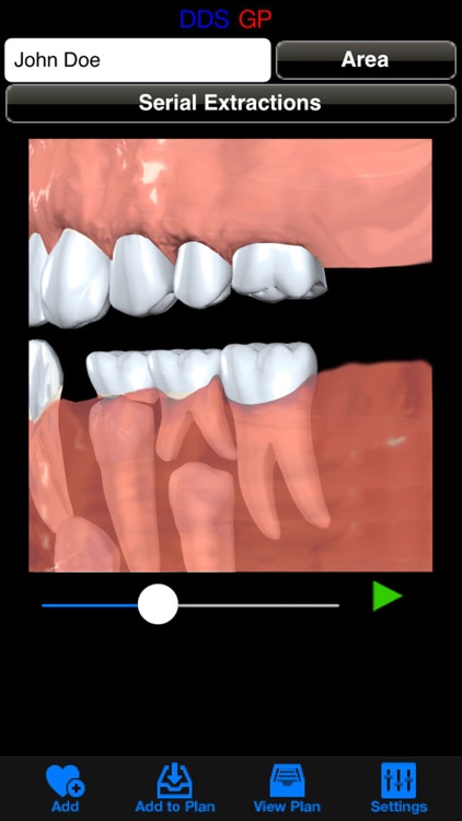 DDS GP screenshot-3