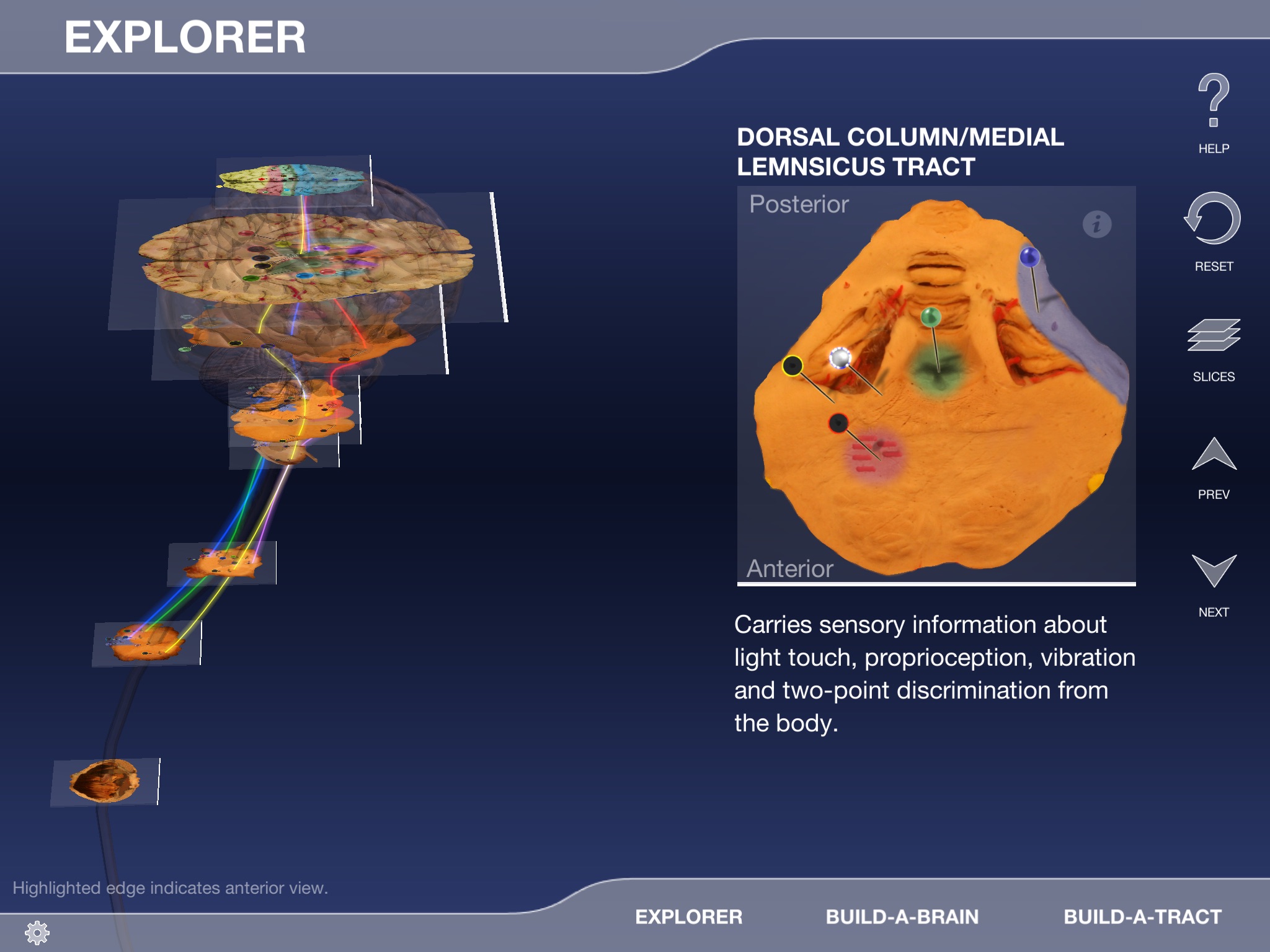 Build-A-Brain Explorer screenshot 2