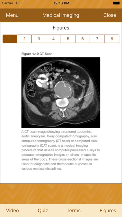 Medical Imaging CT MRI U/S X-Ray