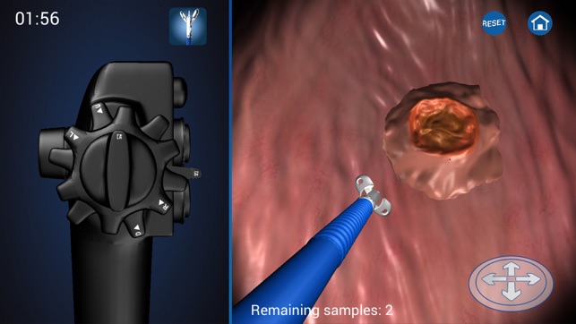 Endoscopy 3D (Ad Version)(圖4)-速報App