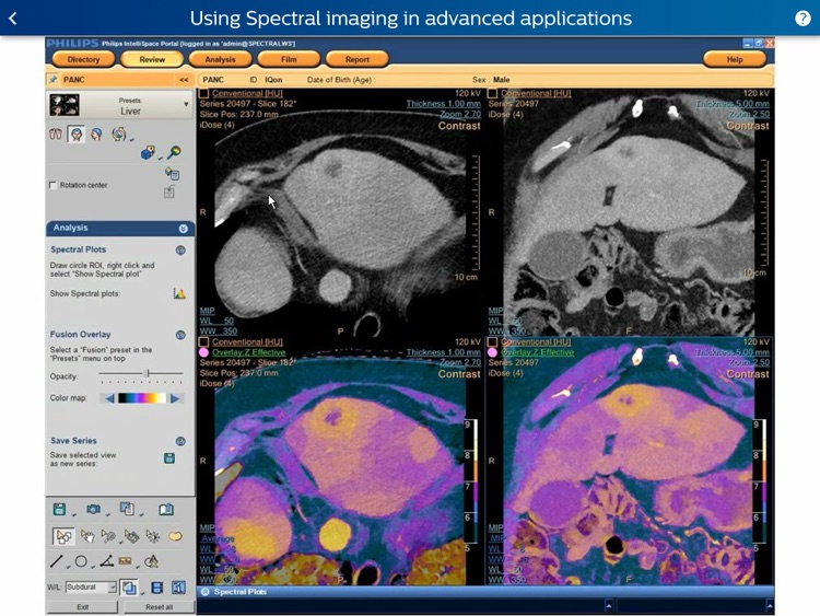 Philips IQon Spectral CT Fundamentals screenshot-3