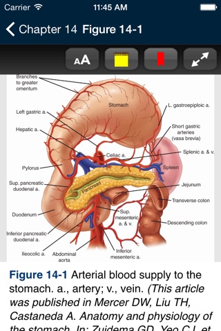 ABSITE Slayer screenshot 4