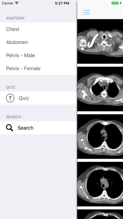 iAnatomy for Patients