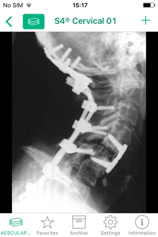 AESCULAP Spine Cervical screenshot 4