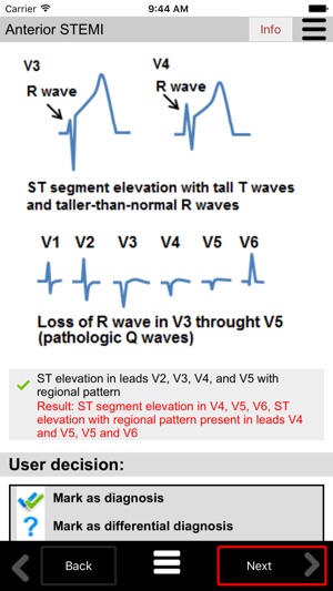 Ecg Calc(圖5)-速報App