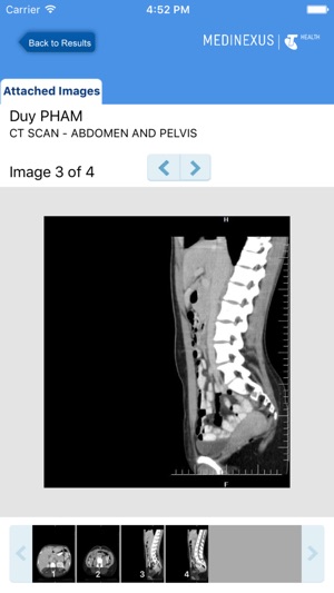 Medinexus Mobile for Patients(圖5)-速報App