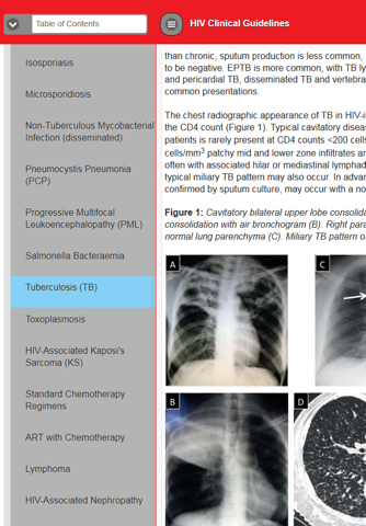 AfA HIV Clinical Guidelines screenshot 3