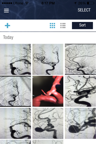 VINA - Cerebrovascular App screenshot 4