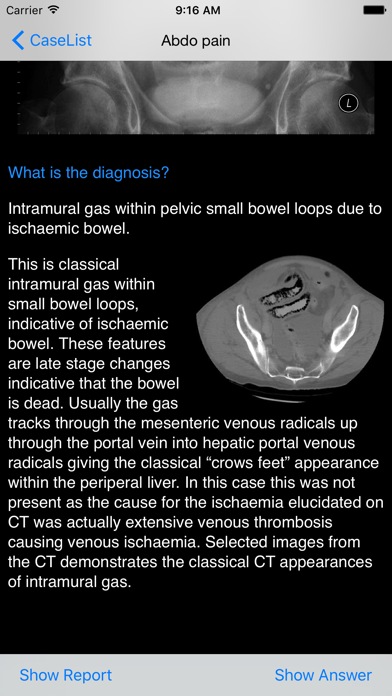 Xrays4Medics Screenshot 5