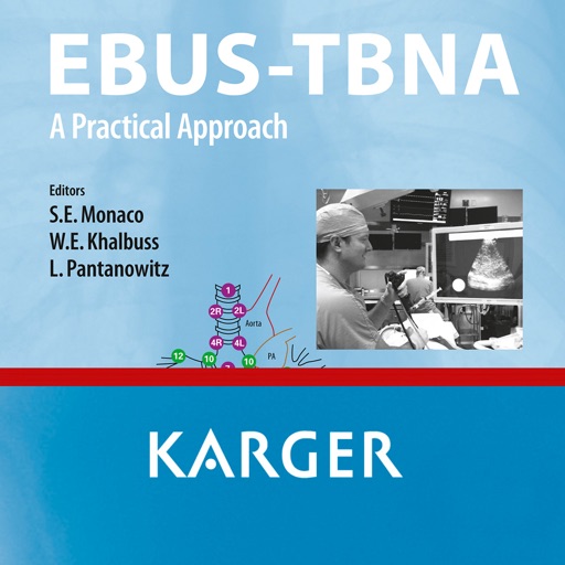EBUS-TBNA: A Practical Approach icon