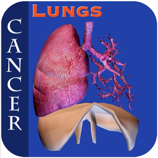 Lungs Cancer V1