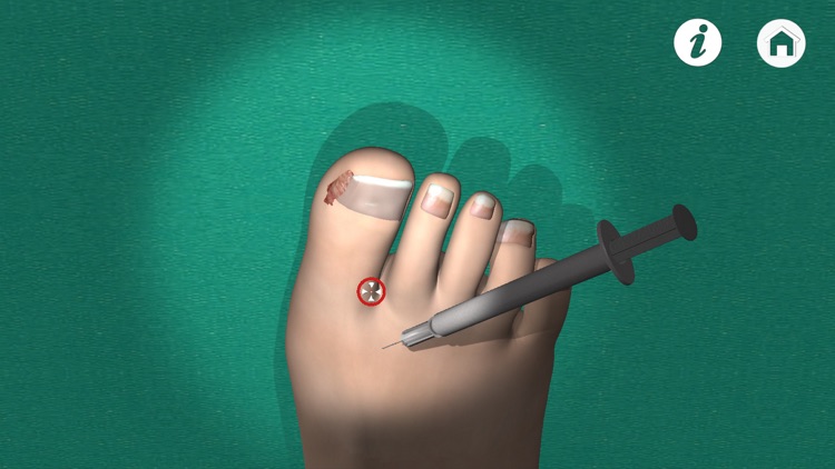 Podiatry 3D (Free Version)