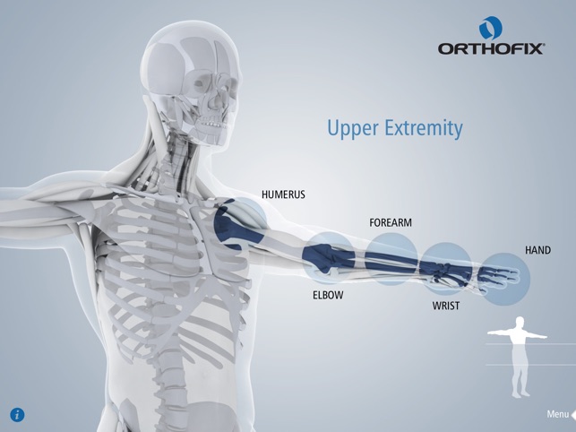 Orthofix Applications by Anatomical Site(圖3)-速報App