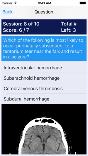 NP Neonatal Review(圖3)-速報App