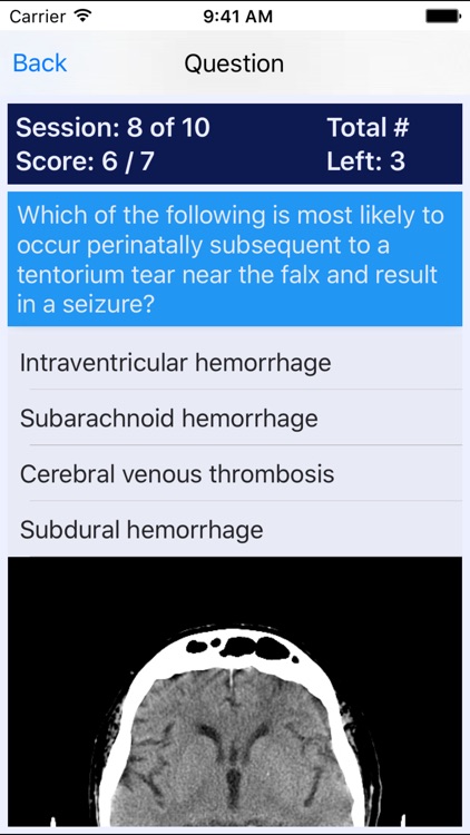 NP Neonatal Review