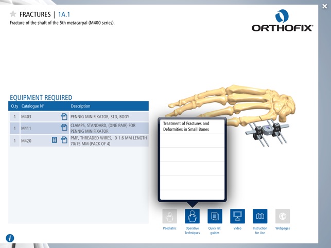 Orthofix Applications by Anatomical Site(圖5)-速報App