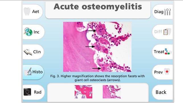 Maxillofacial Pathology(圖3)-速報App