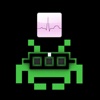 Types ECG Electrocardiogram