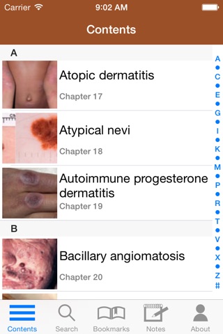 Treatment of Skin Disease screenshot 2