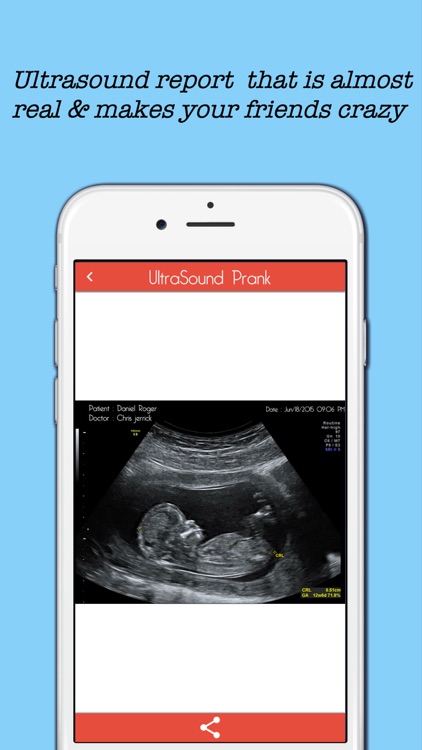 Ultrasound Prank - Best pregnancy spoof