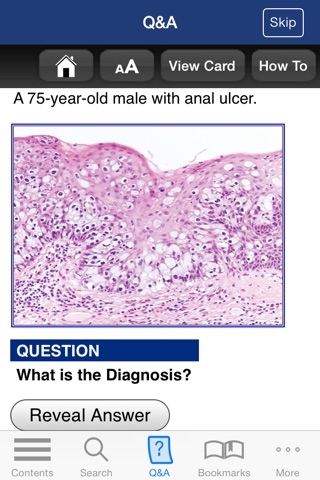 Anatomic Pathology Flashcards screenshot 3