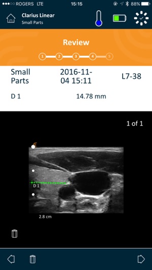 Clarius Ultrasound App(圖5)-速報App