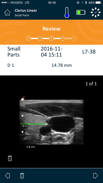 Clarius Ultrasound App screenshot-4