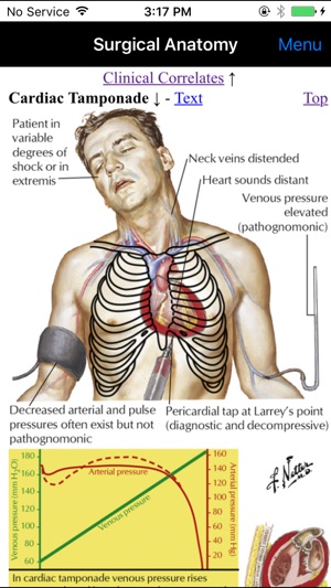 Netter's Surgical Anatomy Review P.R.N.(圖4)-速報App