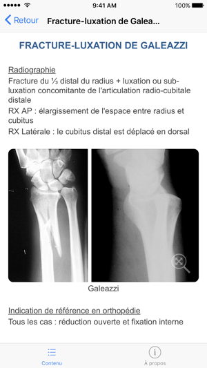 Ortho 911(圖2)-速報App