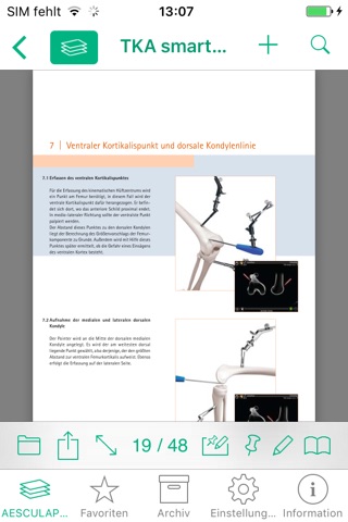 AESCULAP® OrthoPilot® Elite screenshot 3