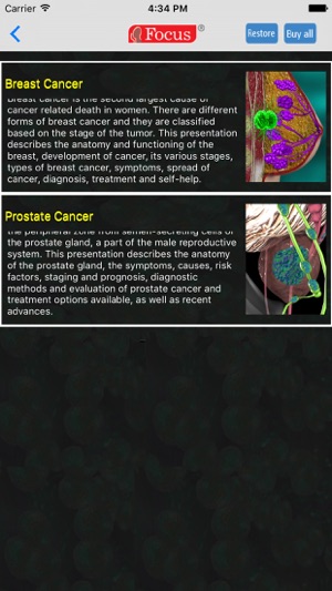 Oncology - Understanding Disease(圖2)-速報App