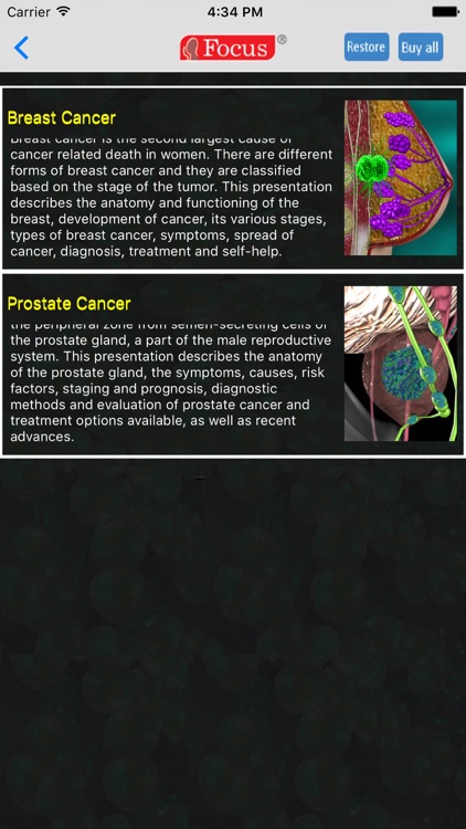 Oncology - Understanding Disease