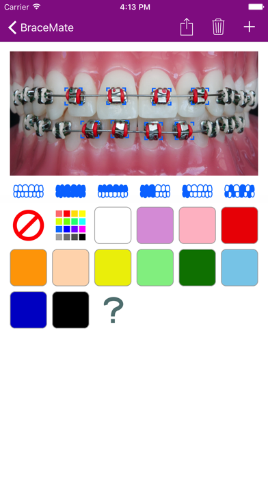 BraceMateのおすすめ画像2