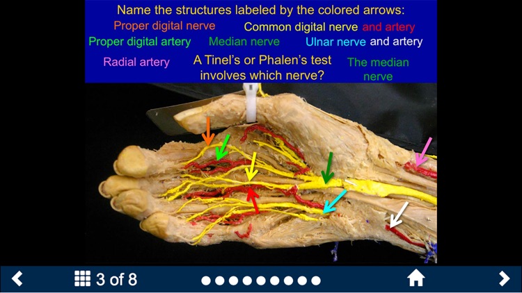 MSK Anatomy Lite - SecondLook screenshot-3