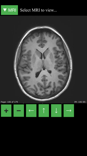 MRI Viewer