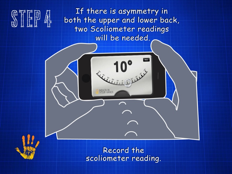 Scoliometer iPad screenshot-4