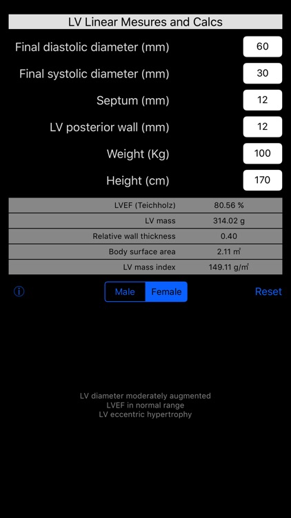LVEF & mass echocardiography calculator