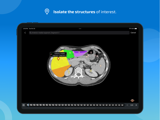IMAIOS e-Anatomy screenshot 4