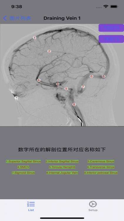 脑血管学习 screenshot-9