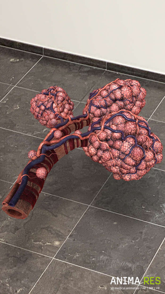 INSIGHT LUNG Enterprise