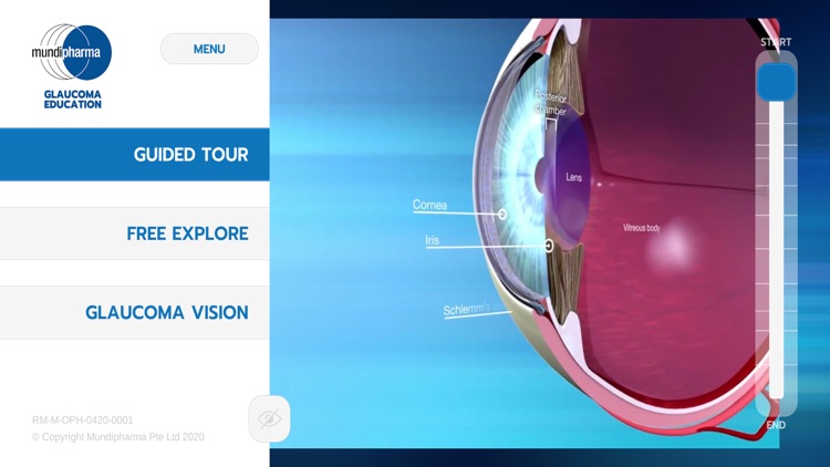 Glaucoma Education