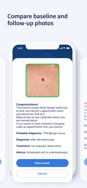 AI Dermatologist: Skin Scanner(圖6)-速報App