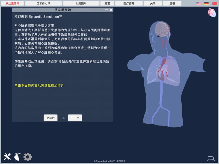 Atrial Fibrillation screenshot-9