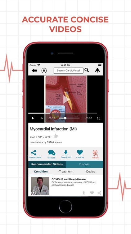 CardioVisual: Heart Health screenshot-3