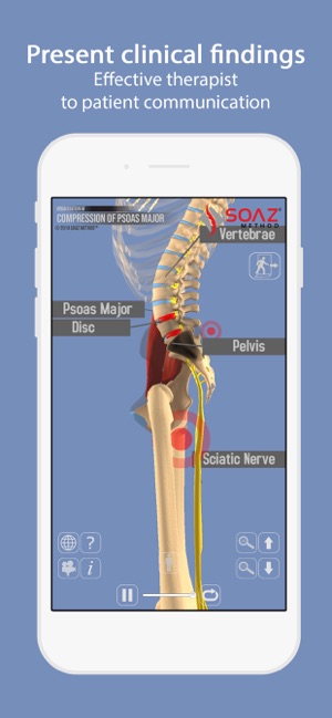 Psoas 3D Interactive Model(圖1)-速報App