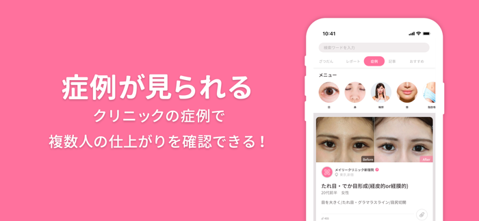 美容整形・美容医療の口コミ・予約アプリ 美容外科検索メイリー