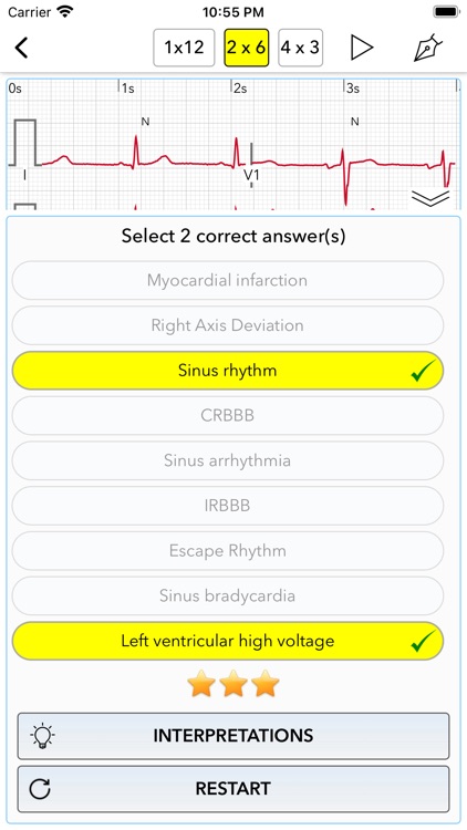 ECG Test Pro screenshot-3